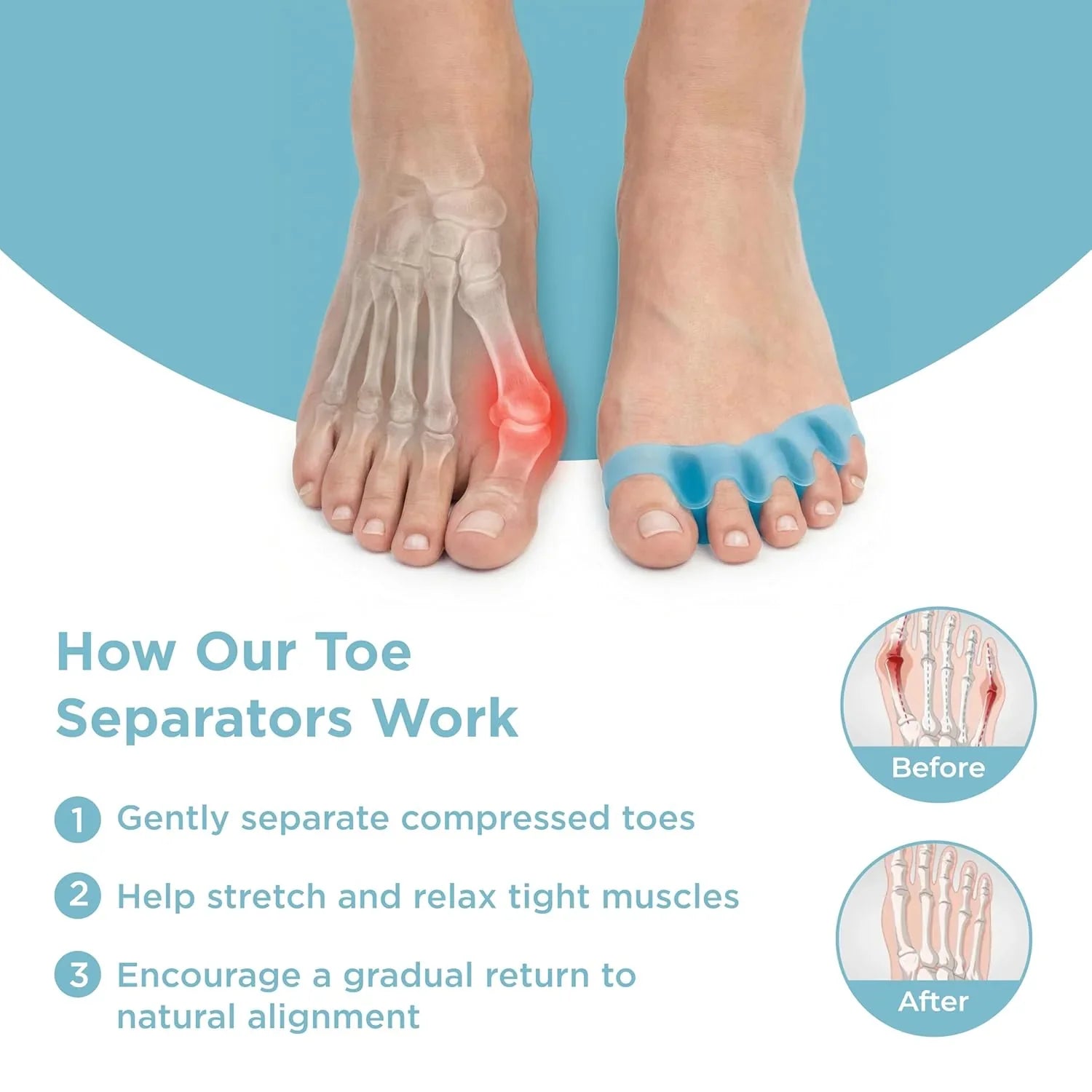 Silicone Toe Straighteners Pack